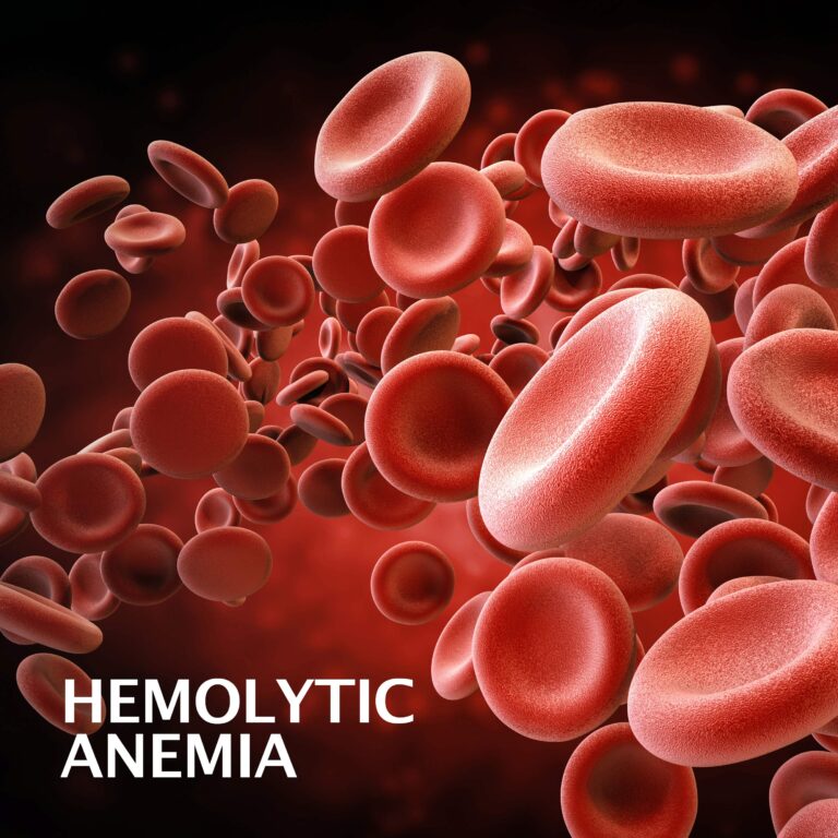 hemolytic-anemia-gastroenterology-of-greater-orlando