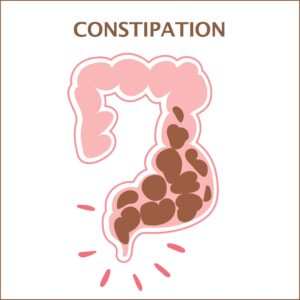 constipation graphic