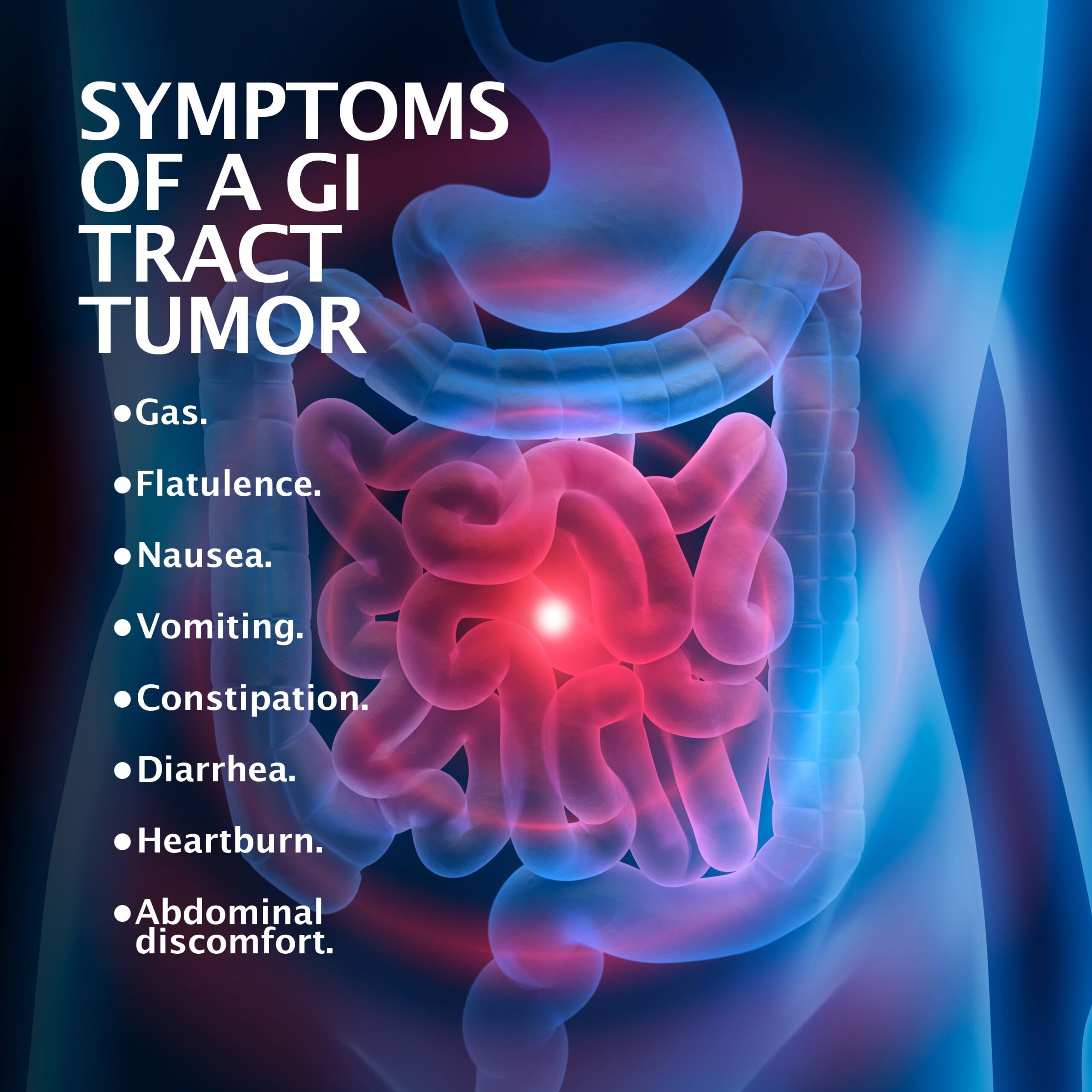 GI tumor symptoms graphic