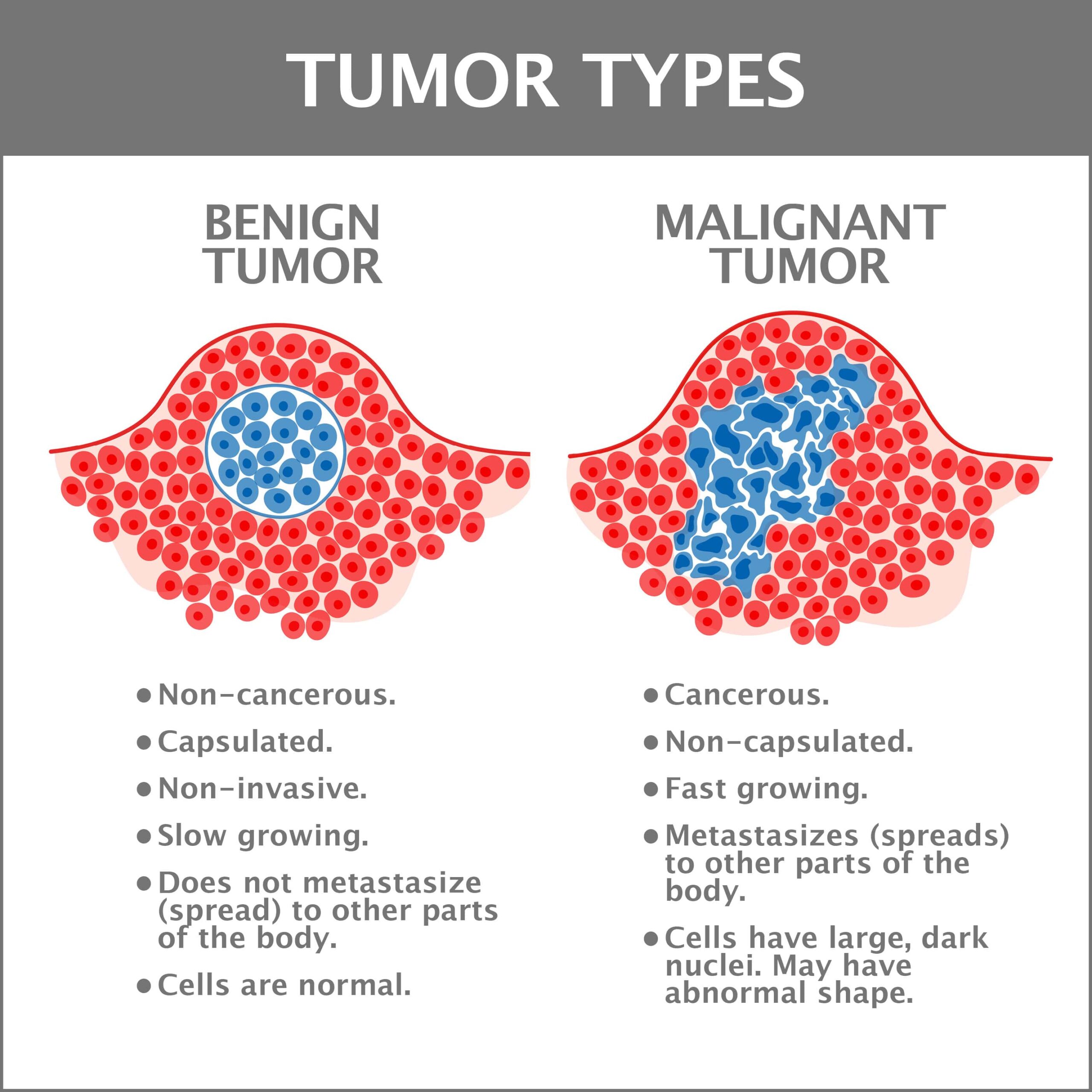Tumor Types Graphic Animation