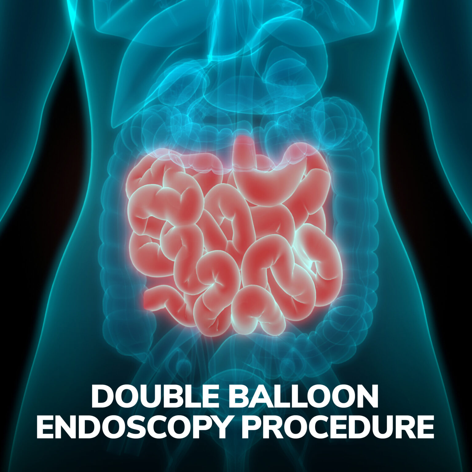 Double Balloon Endoscopy Procedure Gastroenterology of Greater Orlando