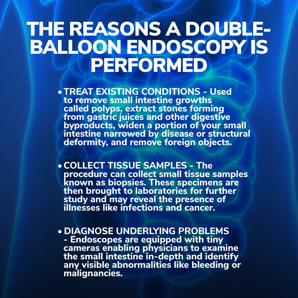 Double Balloon Endoscopy Procedure Gastroenterology of Greater Orlando