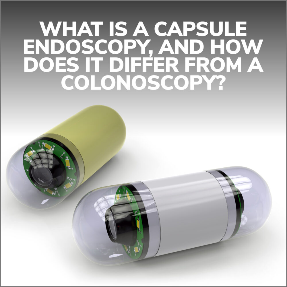 Capsule Endoscopy vs. Colonoscopy Gastroenterology Orlando