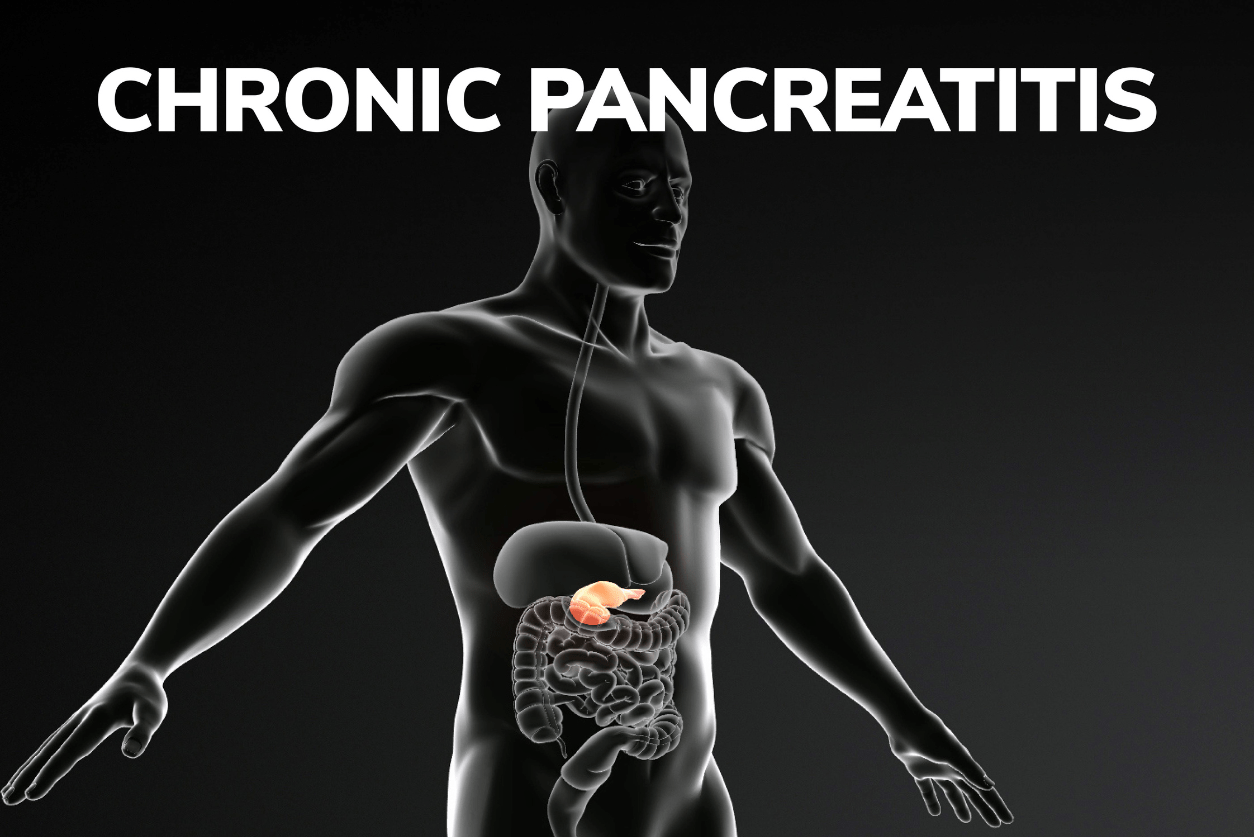 chronic pancreatitis