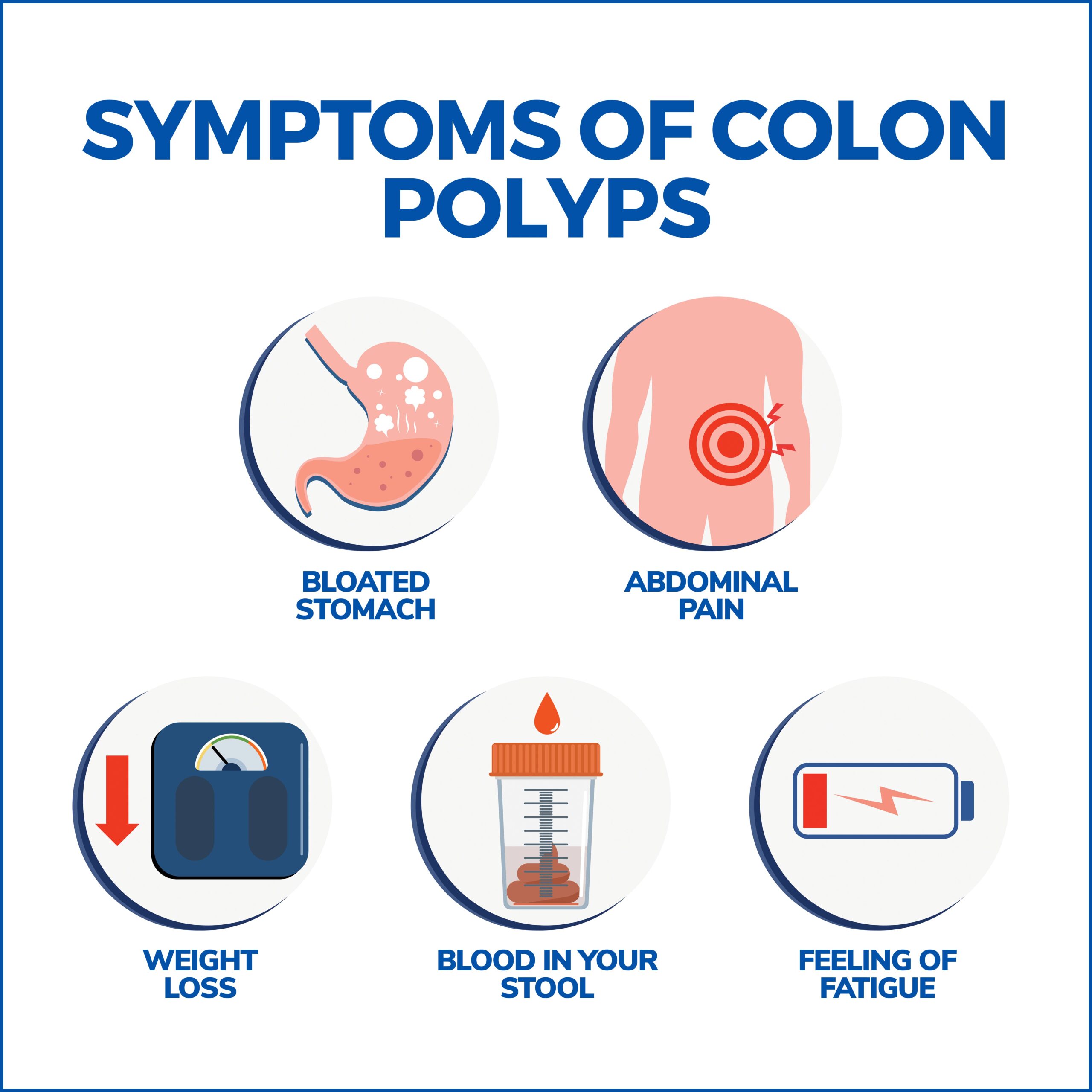 Symptoms of Colon Polyps