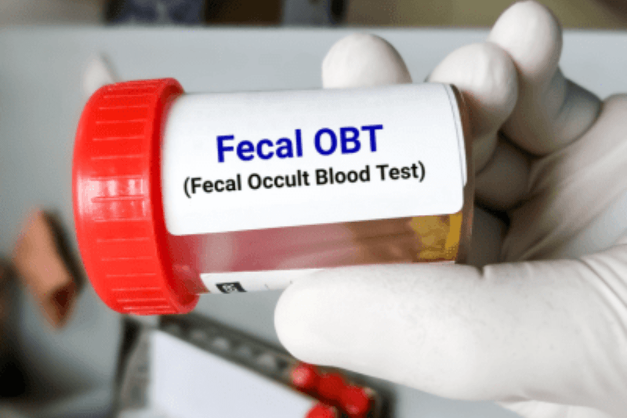 fecal obt blood test